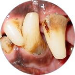 Gel with Wild Salmon Oil. As Seen On TV Pet Dental, Don't Mess with Harsh Chemicals in Your pet's Food or Water, Simply Swipe on Teeth and Your pet's Teeth and Gums Will Improve.