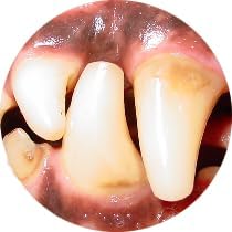 Gel with Wild Salmon Oil. As Seen On TV Pet Dental, Don't Mess with Harsh Chemicals in Your pet's Food or Water, Simply Swipe on Teeth and Your pet's Teeth and Gums Will Improve.